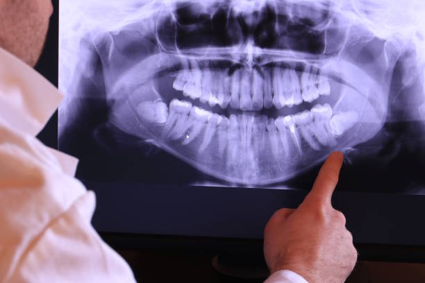 Best Emergency Root Canal Treatment in Enid, OK